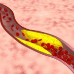 命は血行にある