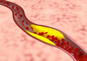 命は血行にある